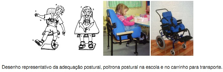 adequação postural tecnologia assistiva